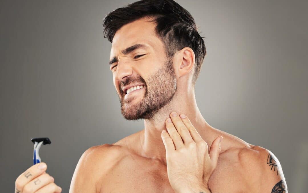 Poils incarnés barbe : Le fléau des barbus et comment s’en défaire ?