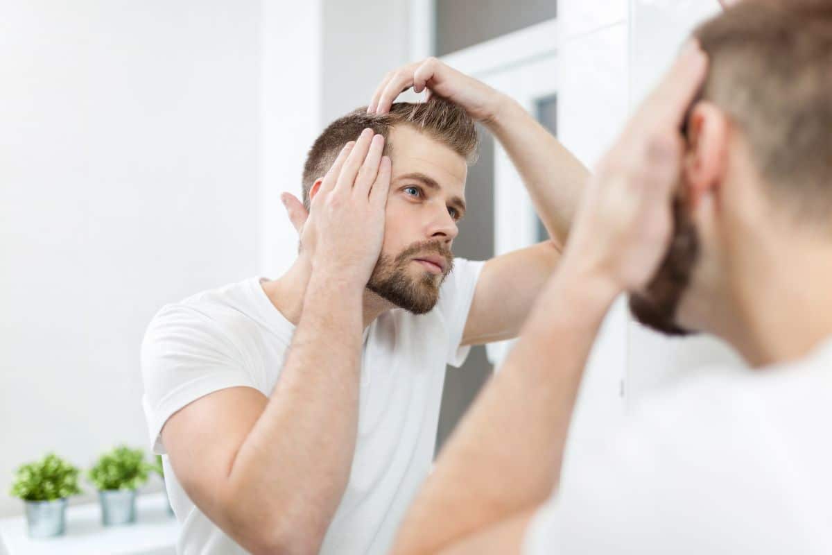 homme et femme stade alopecie