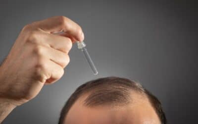 Comment choisir le meilleur minoxidil pour la perte de cheveux ?