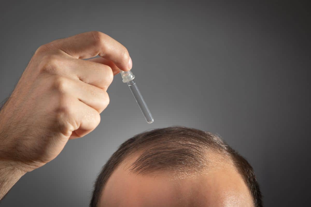 comment bien choisir meilleur minoxidil