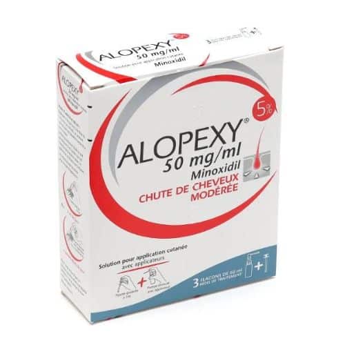 minoxidil alopexy